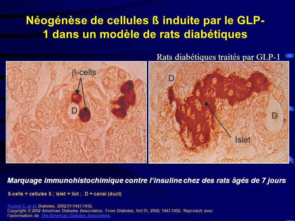 Néogénèse de cellules ß induite par le GLP-1 dans un modèle de rats diabétiques