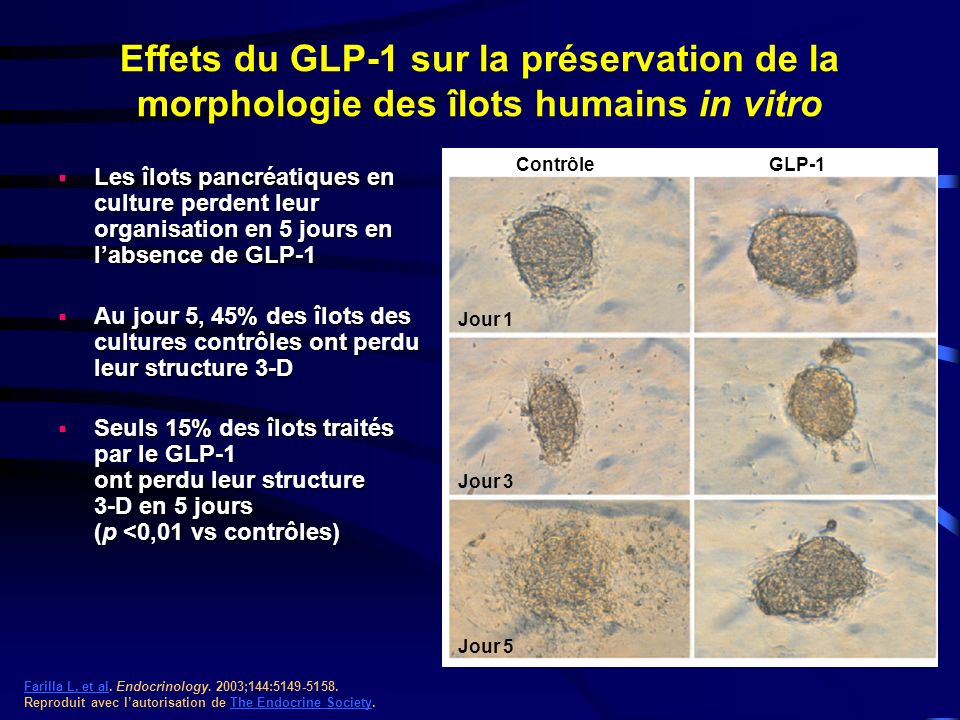 Effets du GLP-1 sur la préservation de la morphologie des îlots humains in vitro