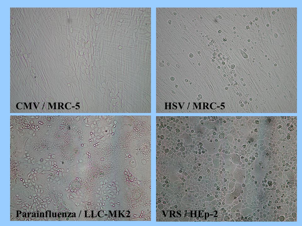 CMV / MRC-5 HSV / MRC-5 Parainfluenza / LLC-MK2 VRS / HEp-2