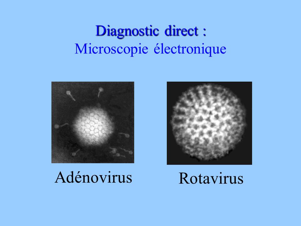 Microscopie électronique