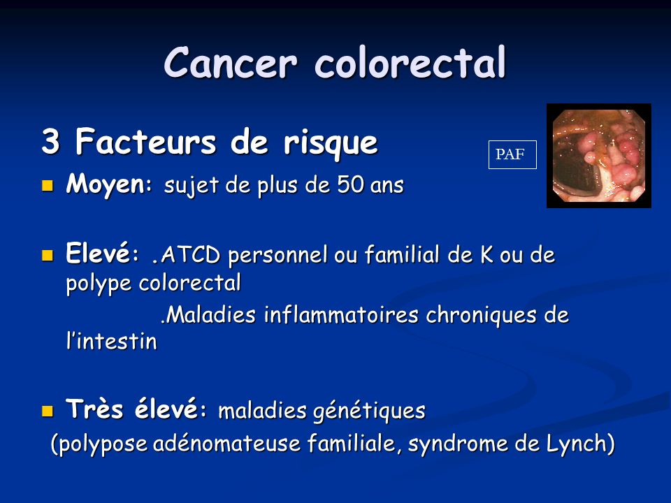Cancer colorectal 3 Facteurs de risque Moyen: sujet de plus de 50 ans