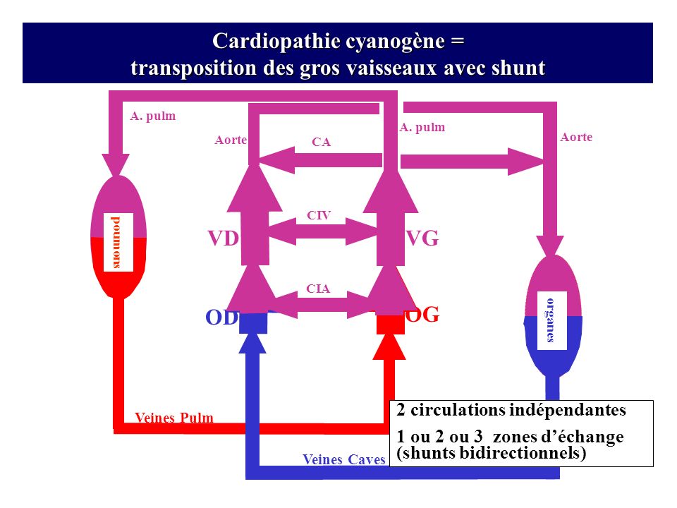 Cardiopathie cyanogène = transposition des gros vaisseaux avec shunt