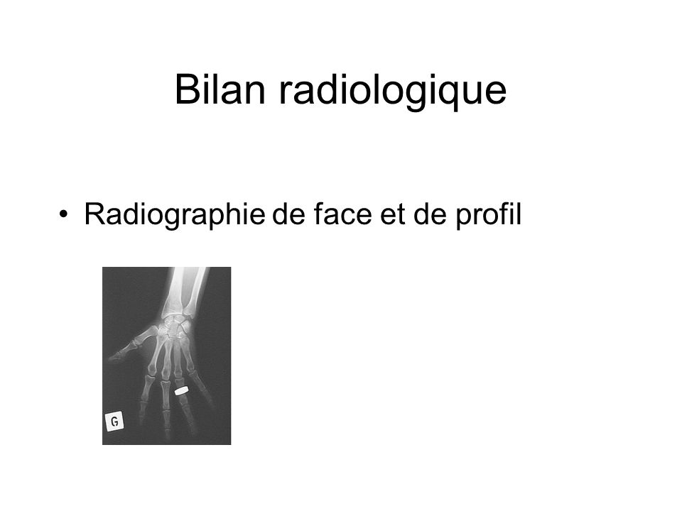 Bilan radiologique Radiographie de face et de profil