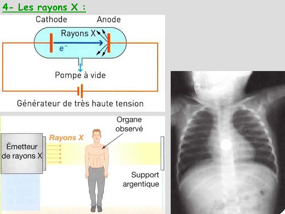 4- Les rayons X :