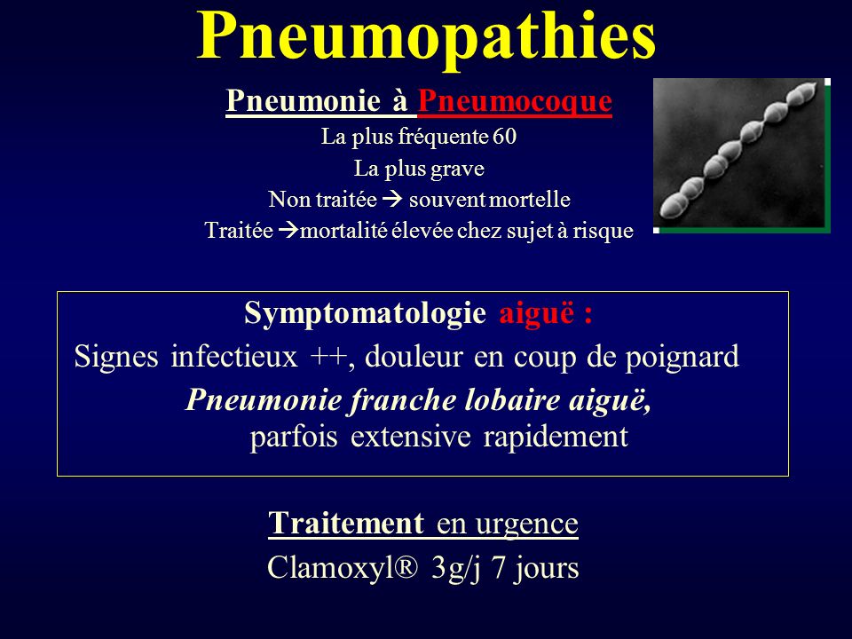 Pneumopathies Pneumonie à Pneumocoque Symptomatologie aiguë :