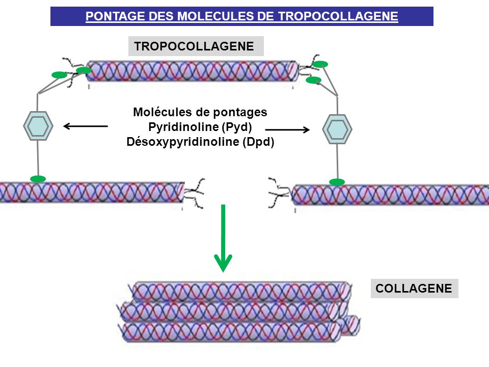 PONTAGE DES MOLECULES DE TROPOCOLLAGENE Désoxypyridinoline (Dpd)