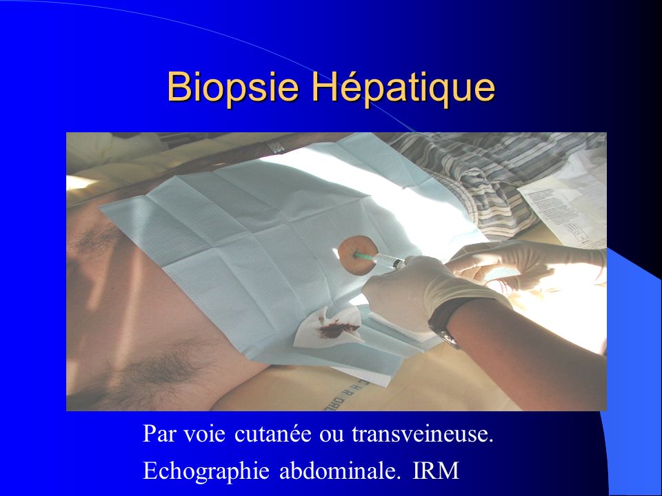 Biopsie Hépatique Par voie cutanée ou transveineuse.