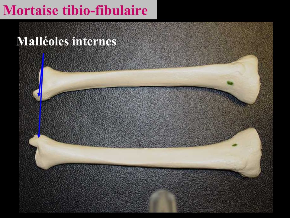 Mortaise tibio-fibulaire