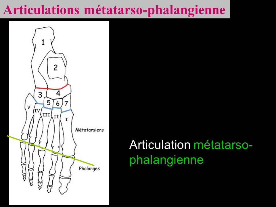 Articulations métatarso-phalangienne