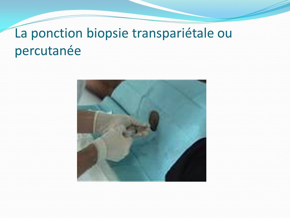 La ponction biopsie transpariétale ou percutanée