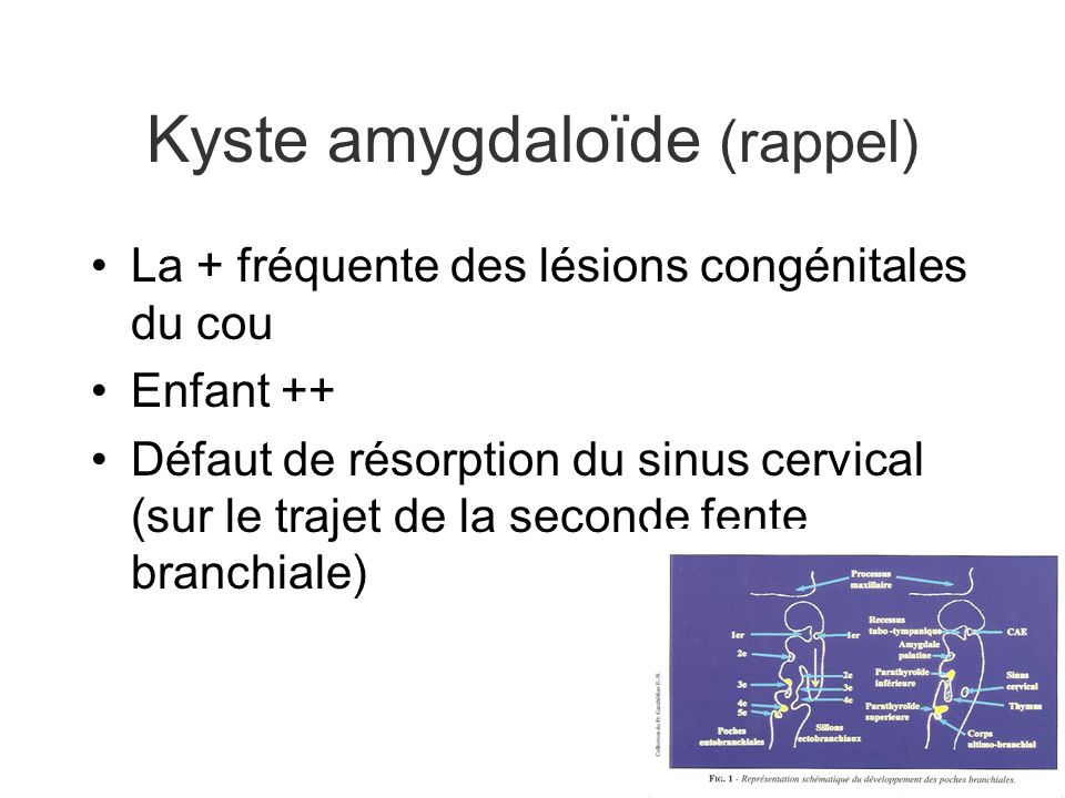 Kyste amygdaloïde (rappel)