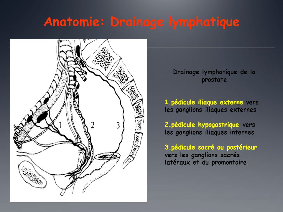 drainage lymphatique prostate