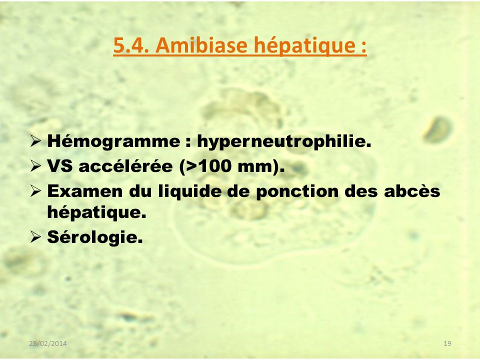 5.4. Amibiase hépatique : Hémogramme : hyperneutrophilie.