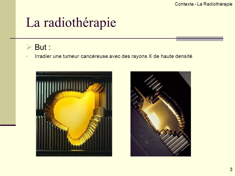 Contexte - La Radiothérapie