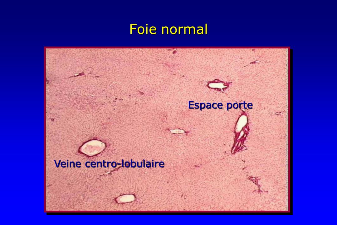 Foie normal Espace porte Veine centro-lobulaire