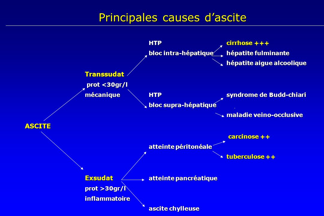 Principales causes d’ascite