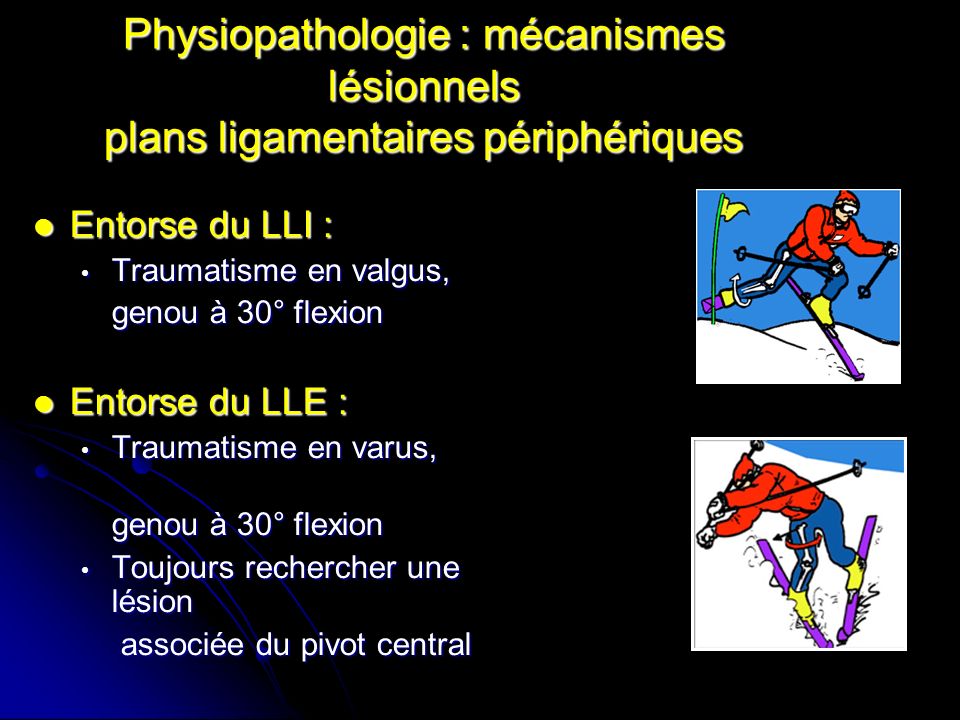Physiopathologie : mécanismes lésionnels plans ligamentaires périphériques