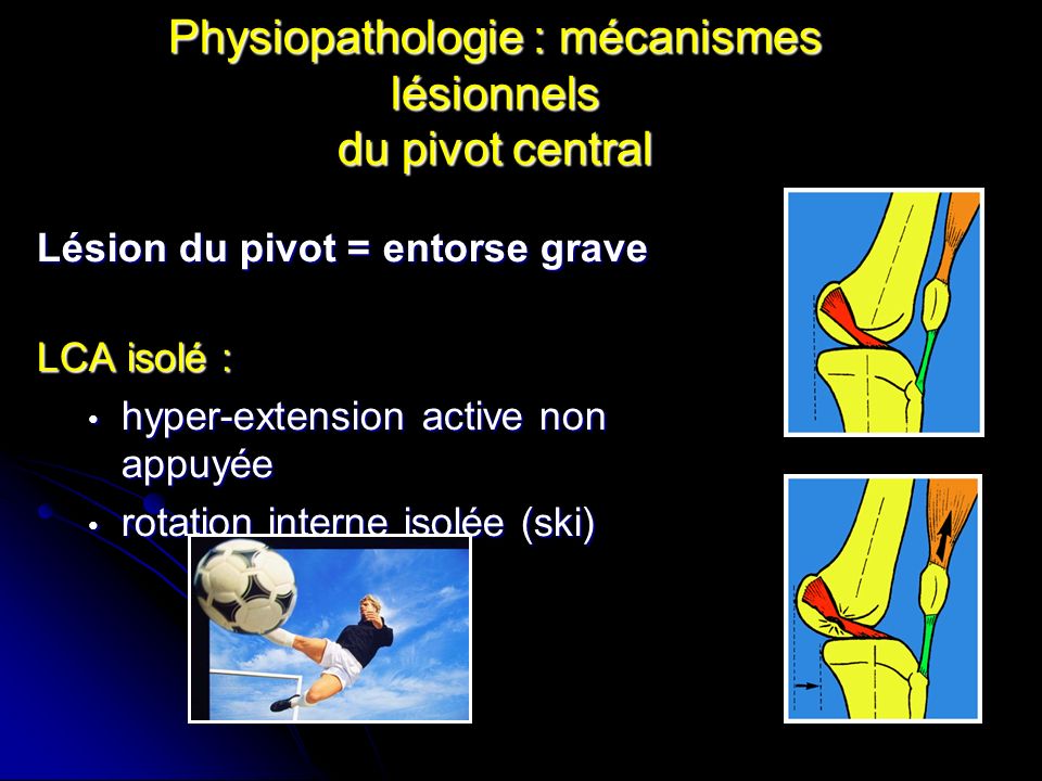 Physiopathologie : mécanismes lésionnels du pivot central