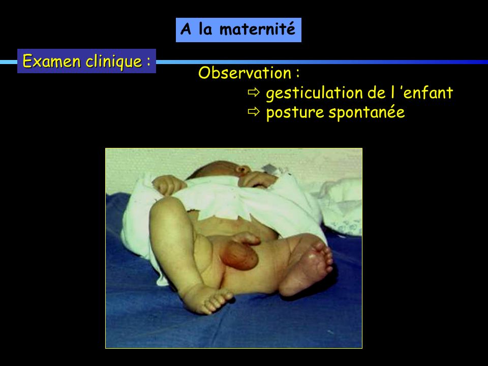 A la maternité Examen clinique : Observation :  gesticulation de l ’enfant  posture spontanée
