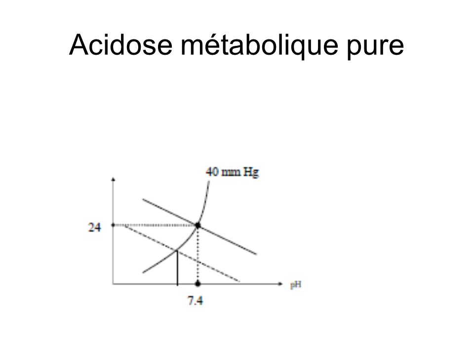Acidose métabolique pure
