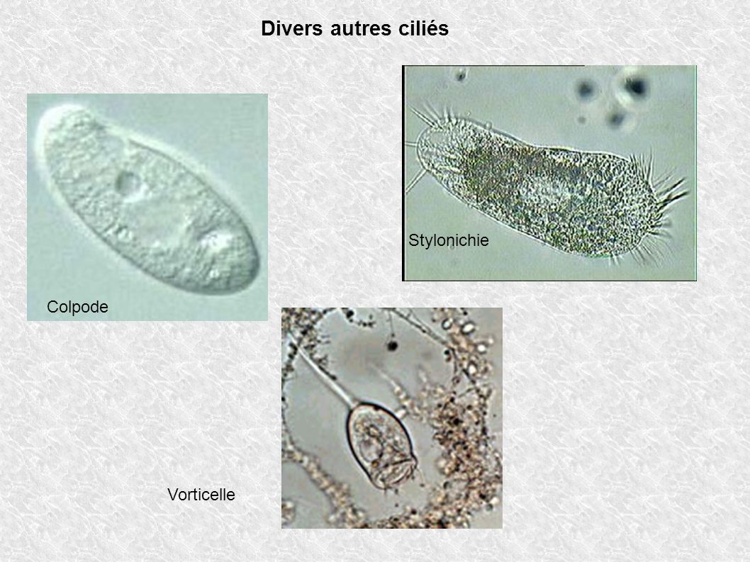 Divers autres ciliés Stylonichie Colpode Vorticelle