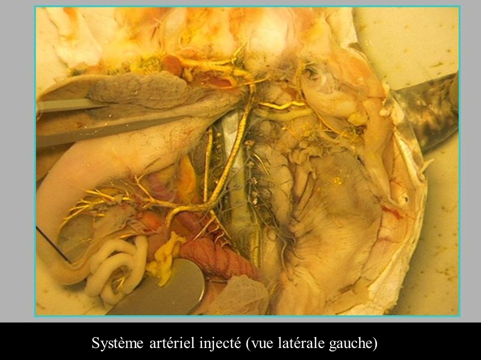 Système artériel injecté (vue latérale gauche)