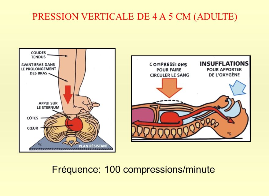 PRESSION VERTICALE DE 4 A 5 CM (ADULTE)