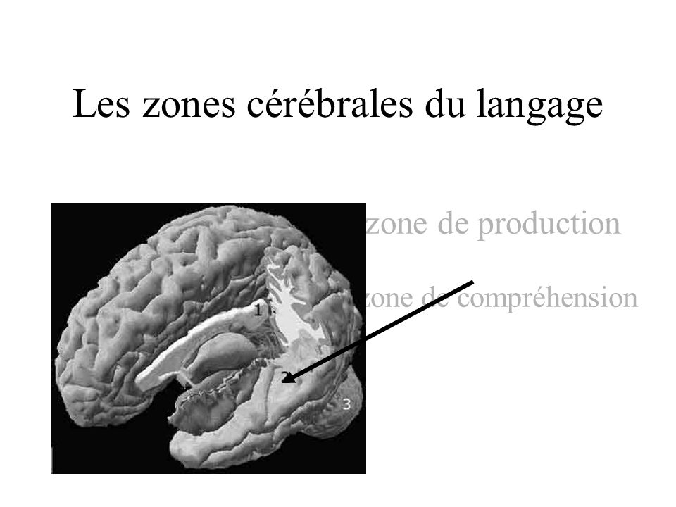 Les zones cérébrales du langage