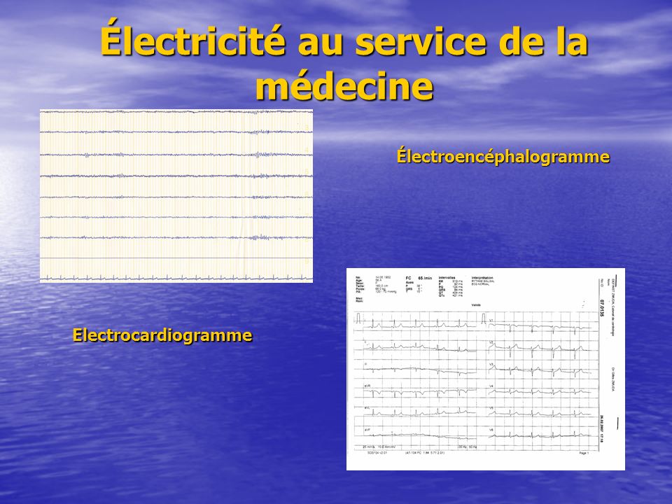 Électricité au service de la médecine