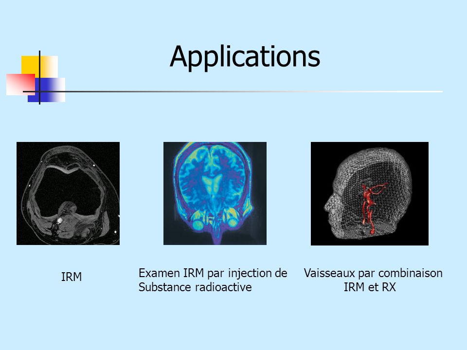 Applications Examen IRM par injection de Substance radioactive