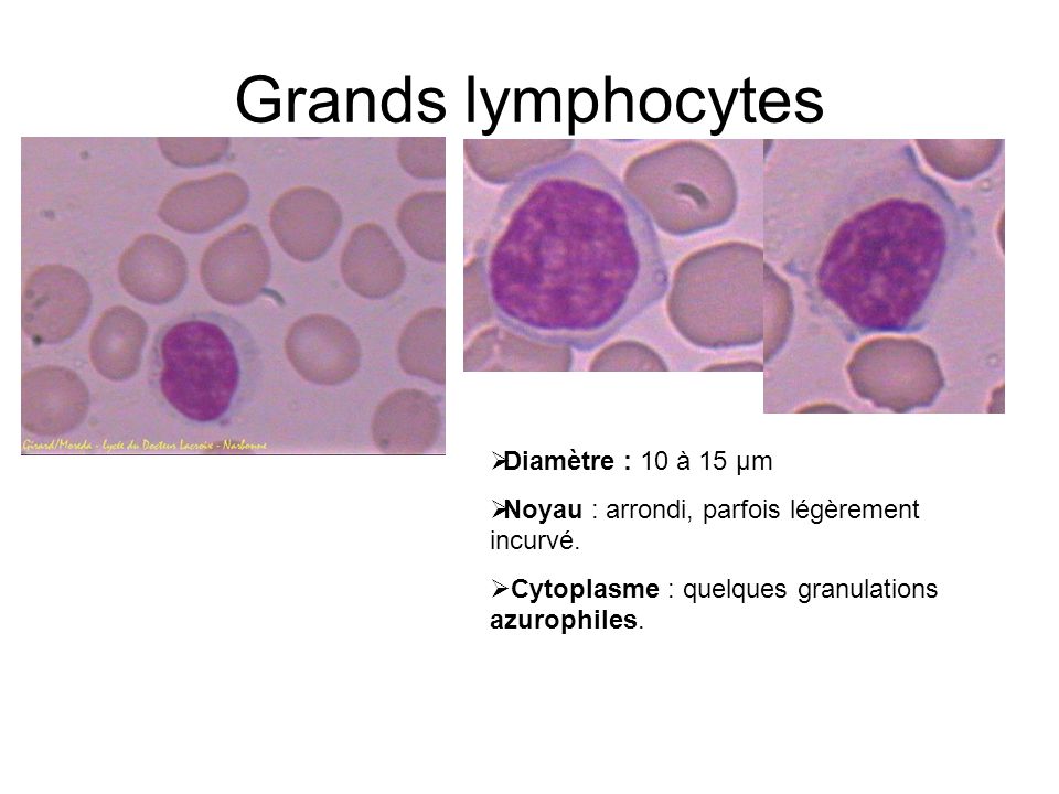 Grands lymphocytes Diamètre : 10 à 15 µm