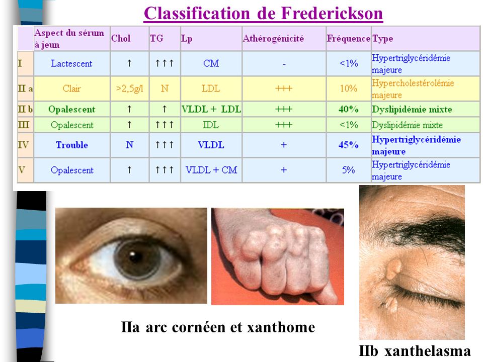 Classification de Frederickson