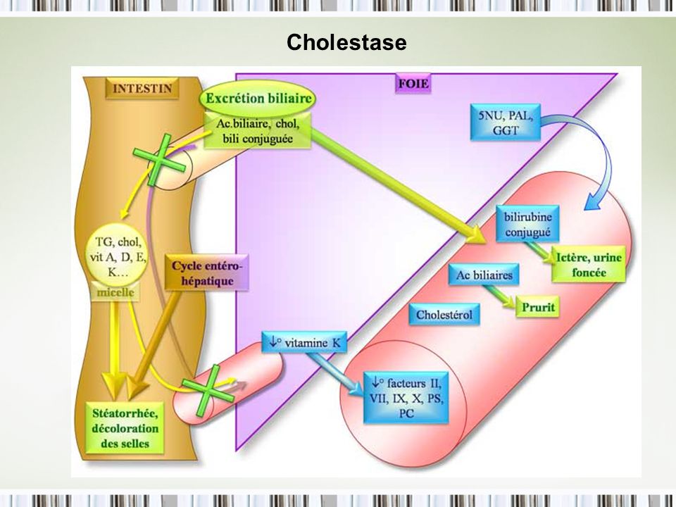 Cholestase