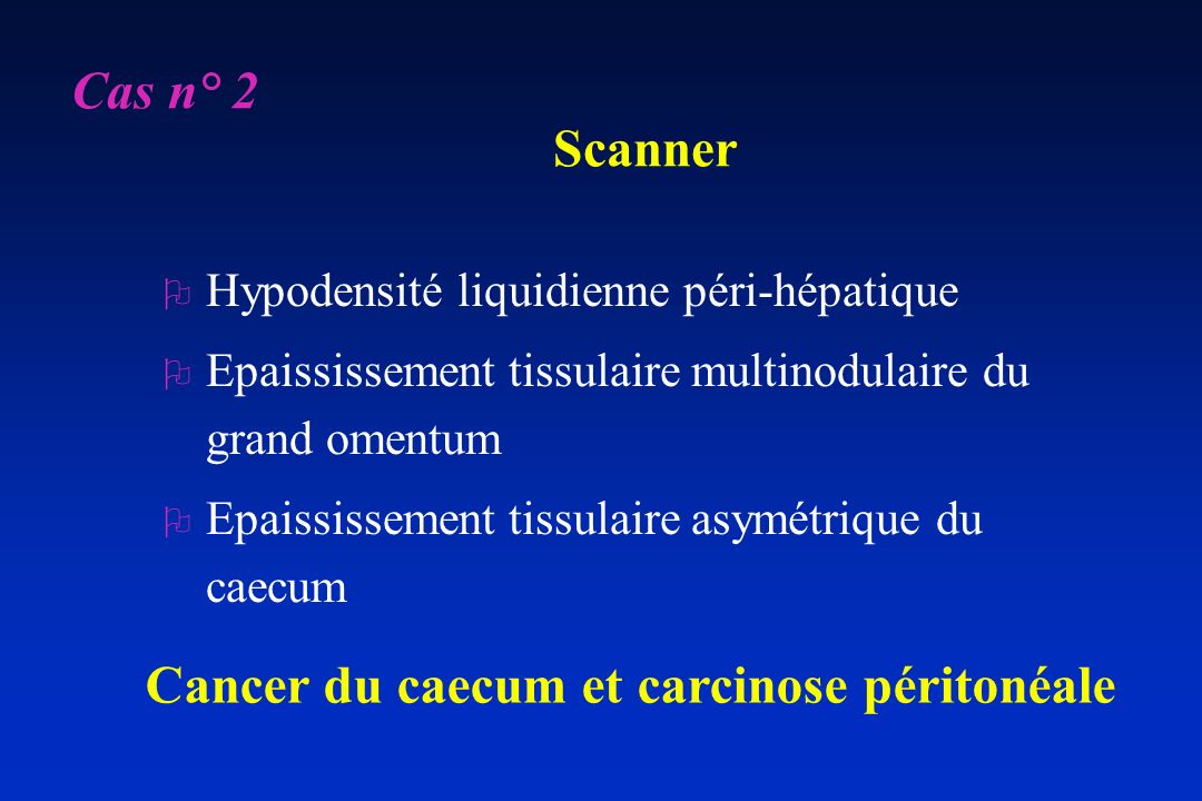 Cancer du caecum et carcinose péritonéale
