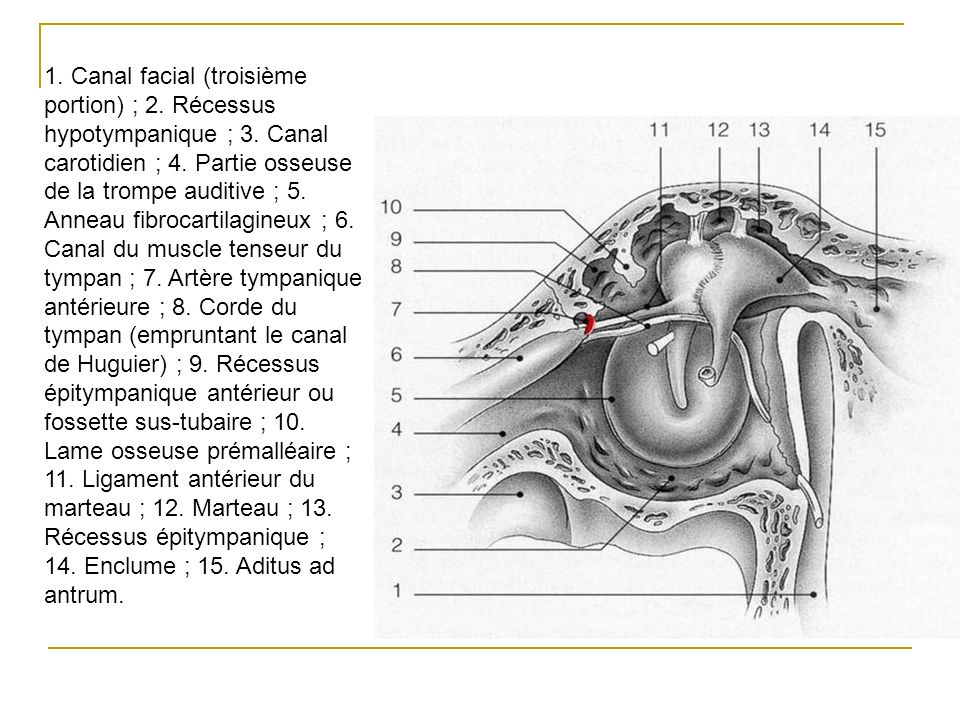 1. Canal facial (troisième portion) ; 2. Récessus hypotympanique ; 3