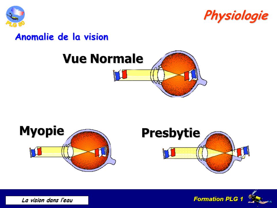 Physiologie Vue Normale Myopie Presbytie Anomalie de la vision