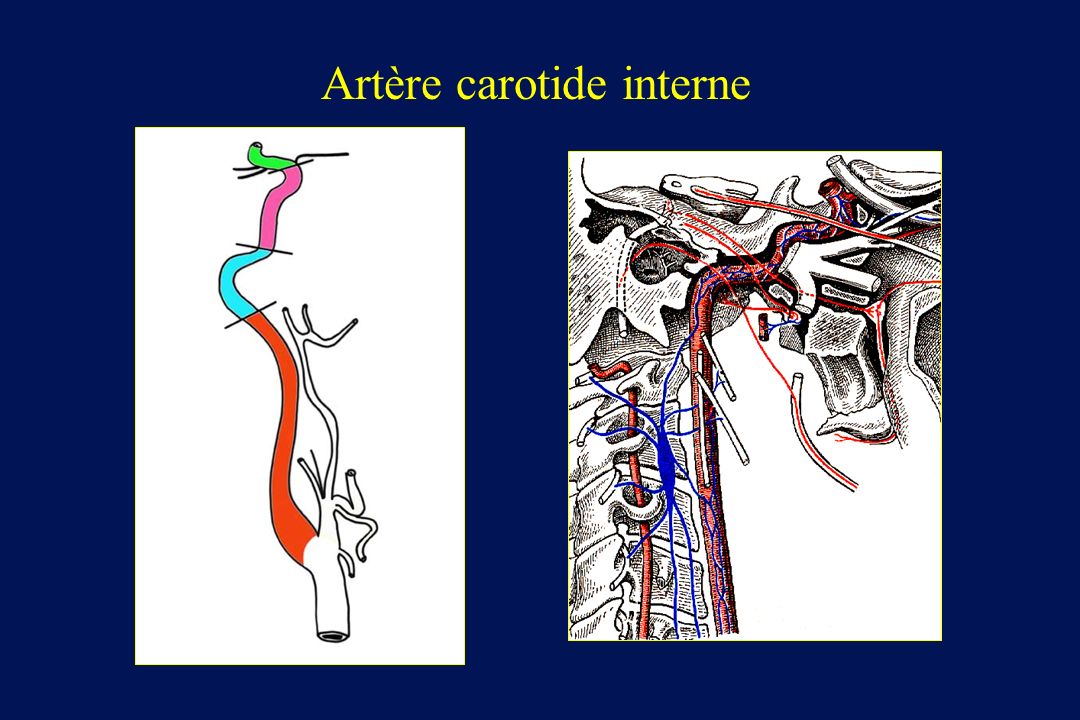 Artère carotide interne