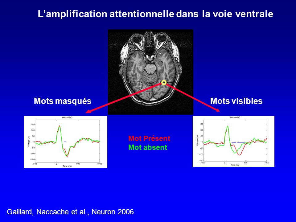 L’amplification attentionnelle dans la voie ventrale