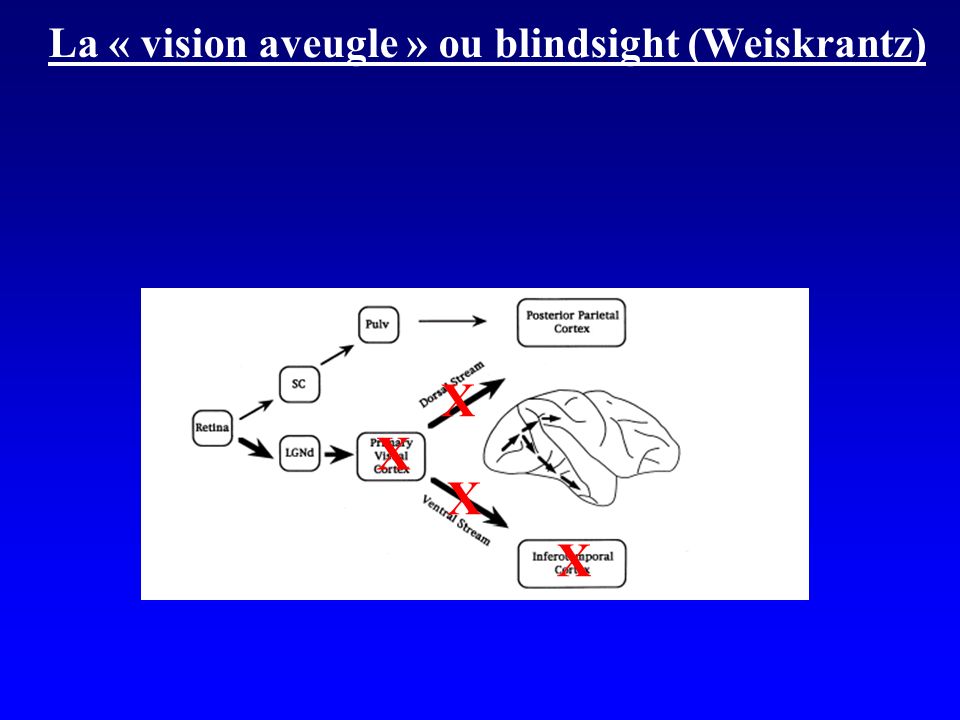 La « vision aveugle » ou blindsight (Weiskrantz)