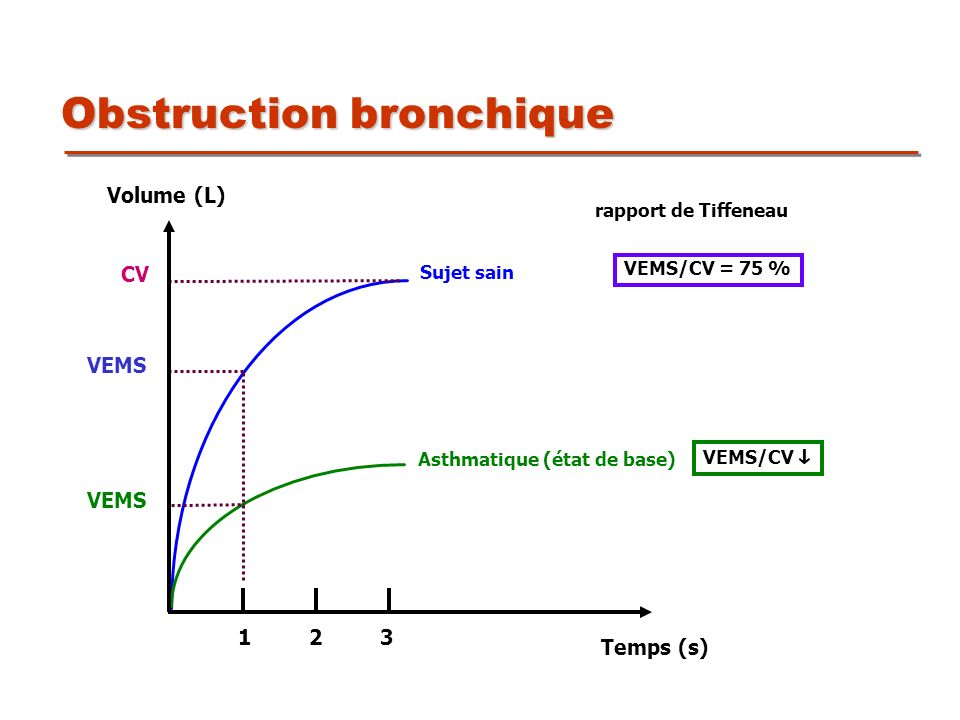 Obstruction bronchique