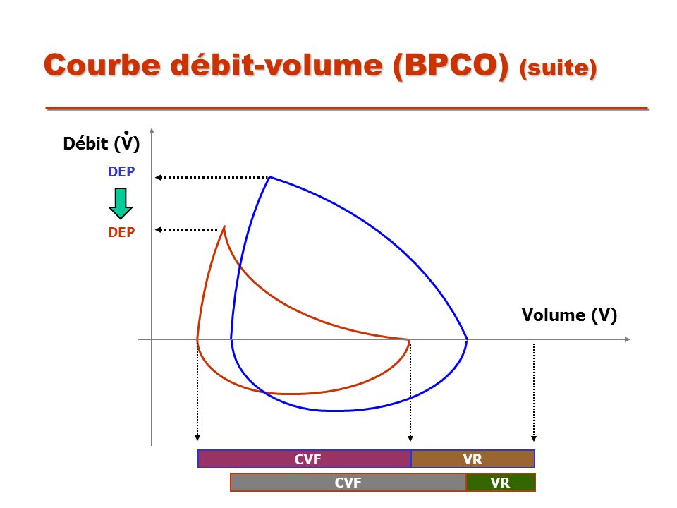 Courbe débit-volume (BPCO) (suite)