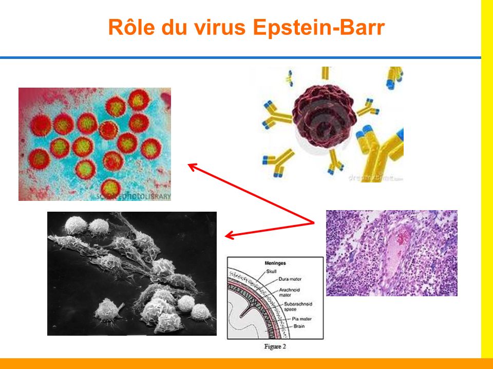 Rôle du virus Epstein-Barr