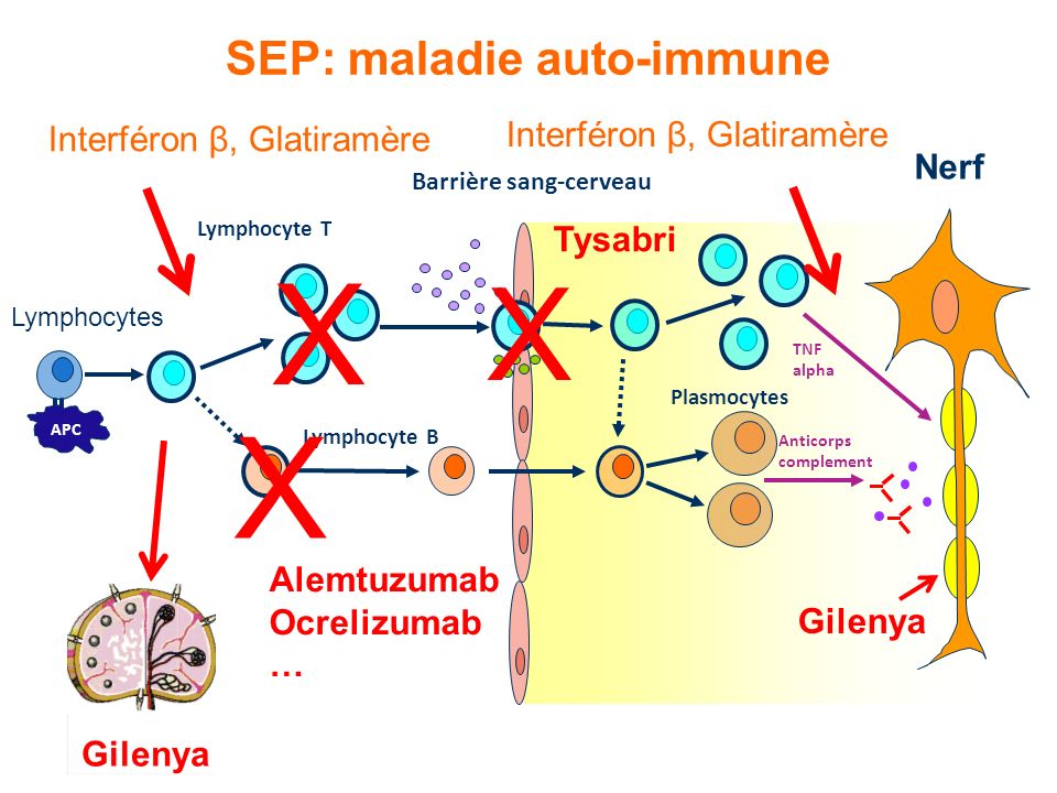 SEP: maladie auto-immune
