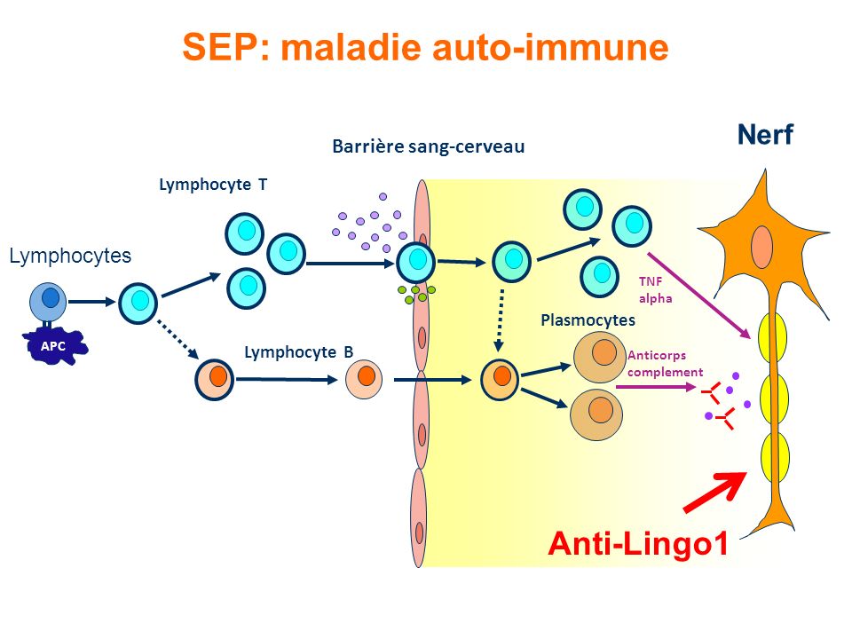 SEP: maladie auto-immune