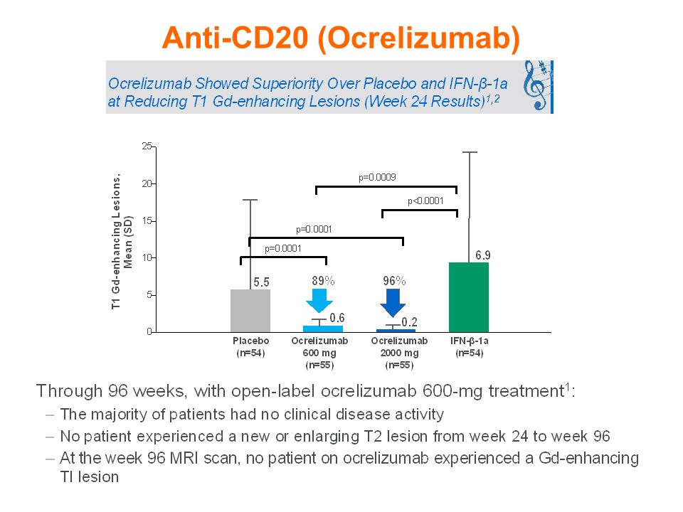 Anti-CD20 (Ocrelizumab)