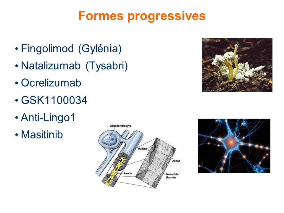 Formes progressives Fingolimod (Gylénia) Natalizumab (Tysabri)