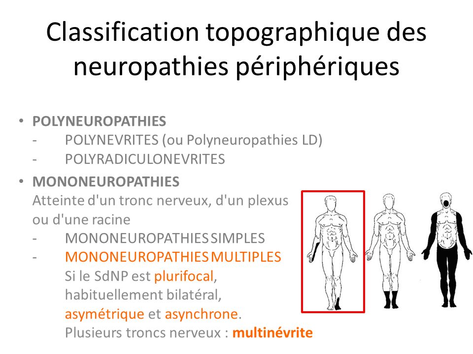 Neuropathies périphériques (pathologie) - ppt télécharger