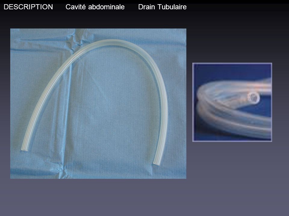 DESCRIPTION Cavité abdominale Drain Tubulaire