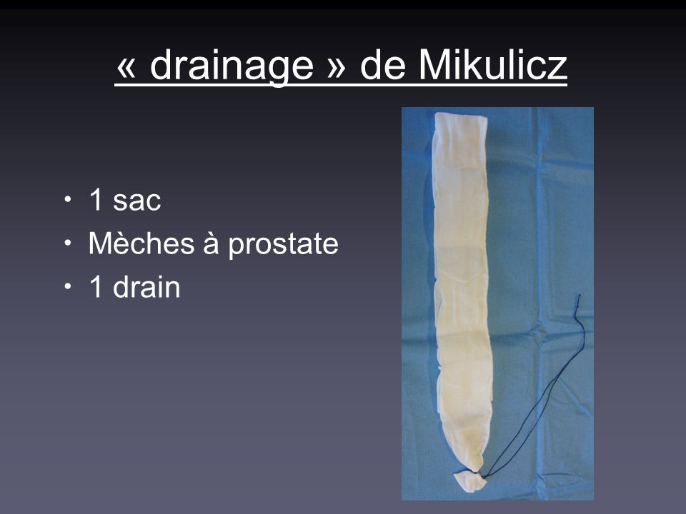 « drainage » de Mikulicz