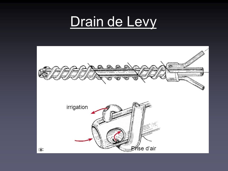 Drain de Levy irrigation Prise d’air